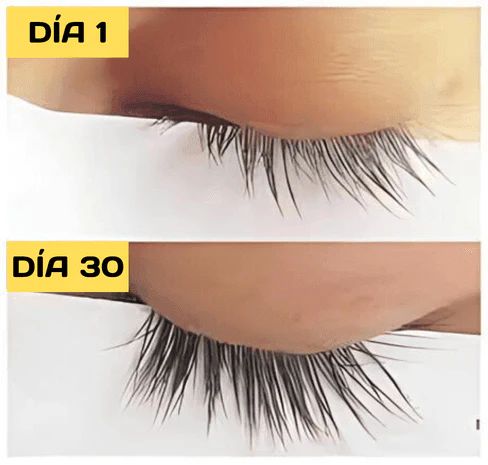 Aplicación del serum