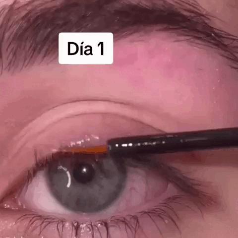 Resultados del serum