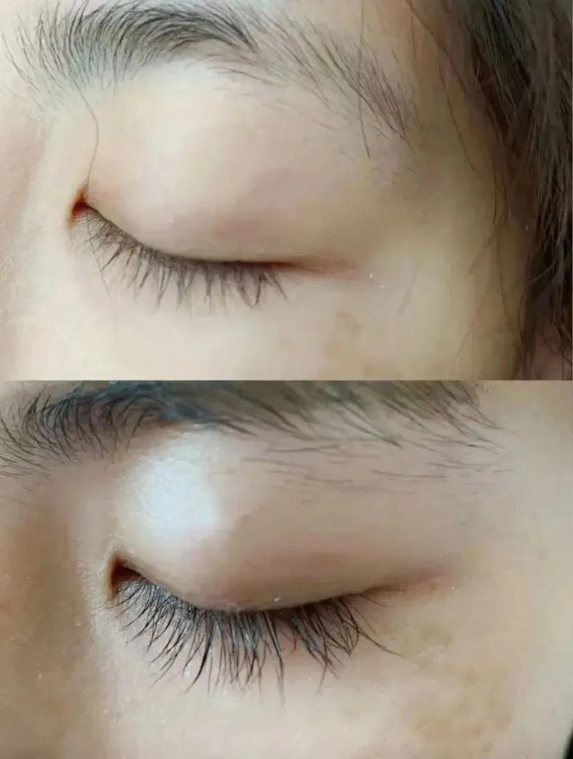 Antes y despues
